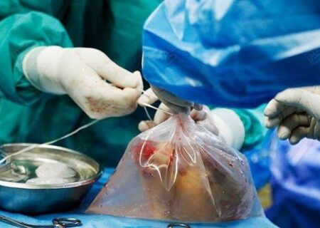 تداوم نبض زندگی در جسمی دیگر