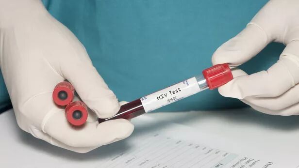 بحرانهای جهانی پیشرفت در مبارزه با ایدز را کند کرده است