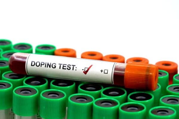 برنامه ویژه نادو برای کاروان المپیک/دو مرحله تست از مسافران پاریس