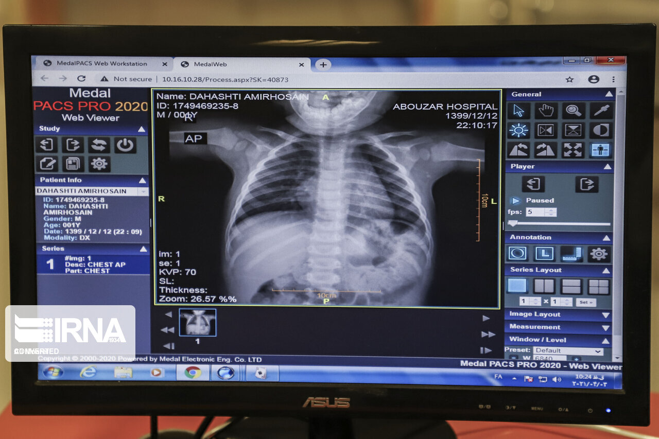 تجهیز بیمارستان های انتظامی به سیستم موبایل پکس