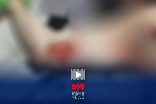 تصاویر بسیار دلخراش از آثار به‌جای‌مانده بر پیکر قربانیان اغتشاشات