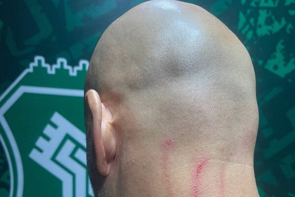 جراحت مربی دروازهبانهای استقلال در پایان بازی با خیبر