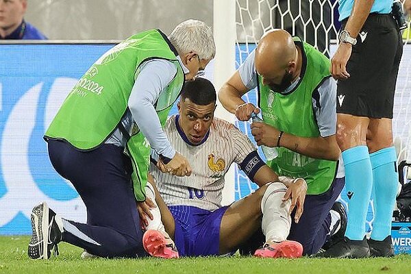 خبر خوش برای فرانسه/ امباپه نیازی به جراحی بینی ندارد