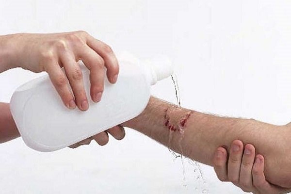 خدمات بهداشتی به ۳۴۳۶ مورد حیوان گزیدگی در کردستان ارائه
شد