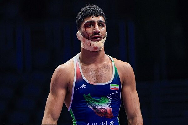 «صورت زخمی» به مدال برنز جهان رسید/ سهرابی شایستهای که به طلا نرسید