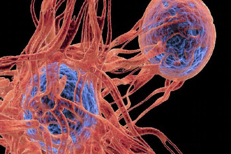 کارشناس علوم پزشکی: حدود ۵۰ درصد سرطانها در صورت تشخیص به موقع قابل درمان است