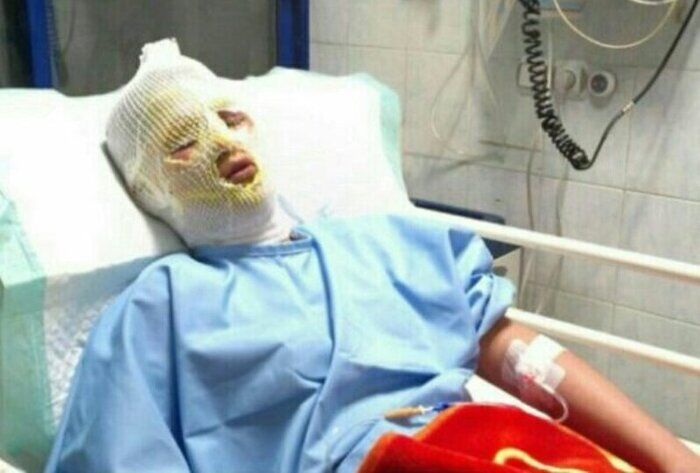 ۲ نفر در حادثه انفجار مواد محترقه دستساز در اردبیل مصدوم شدند