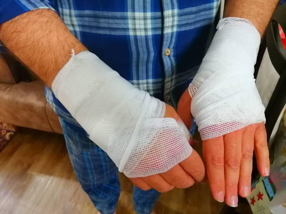 ۴۶ درصد مصدومان حوادث چهارشنبه سوری کودک و نوجوان هستند