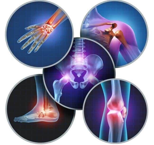 ۷۰ درصد زنان در معرض خطر پوکی استخوان به مراکز درمانی مراجعه نمی‌کنند