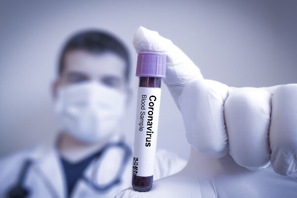 درمان آنتی بادی کرونا وارد مرحله سوم آزمایش می شود